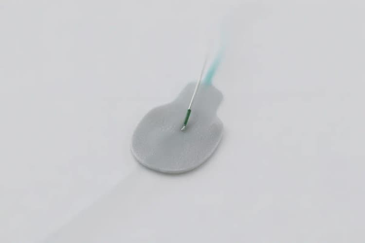 Um close-up de um sensor de monitoramento contínuo de glicose, mostrando detalhes do adesivo e da agulha fina.